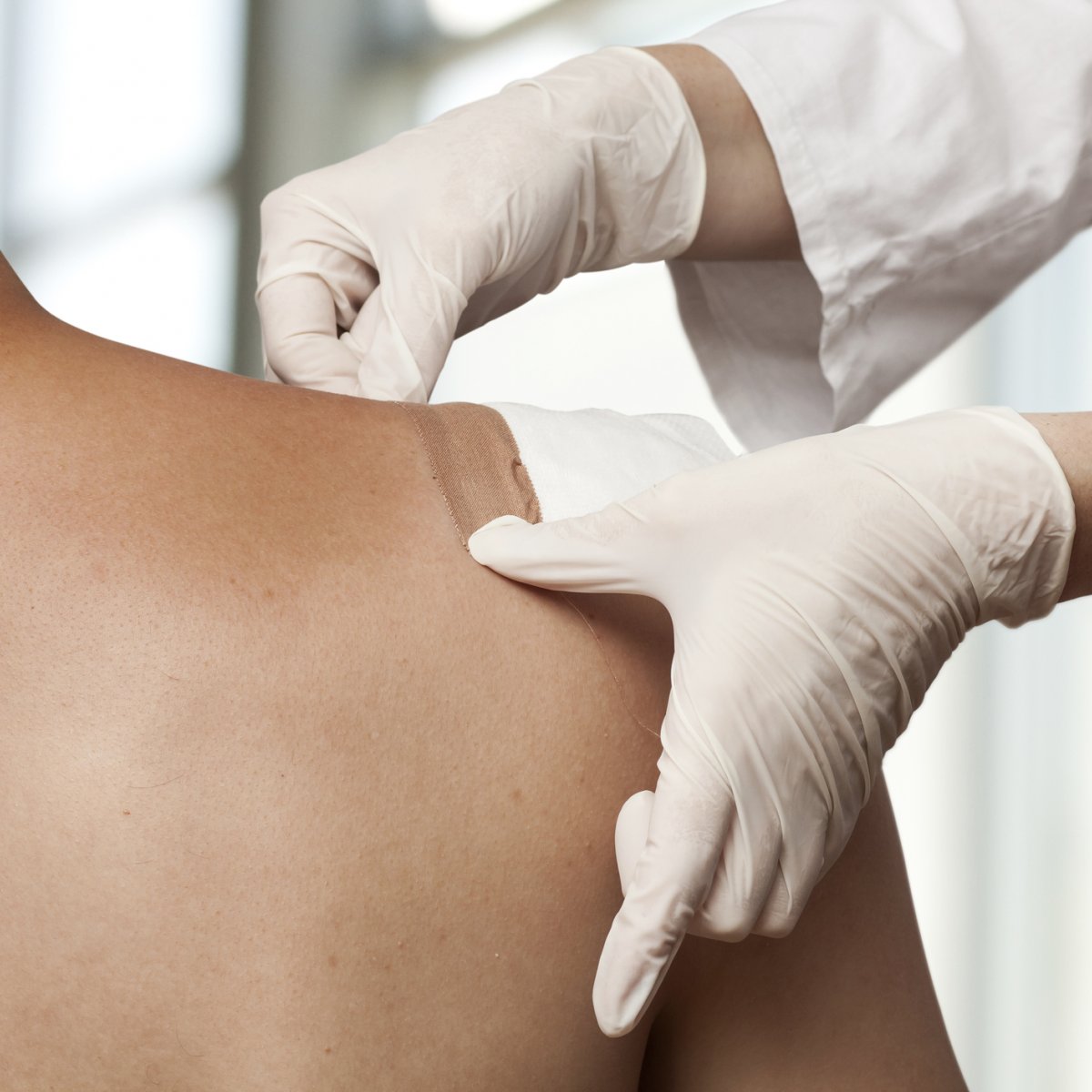 Innovating chronic wound treatment Innovating chronic wound treatment
